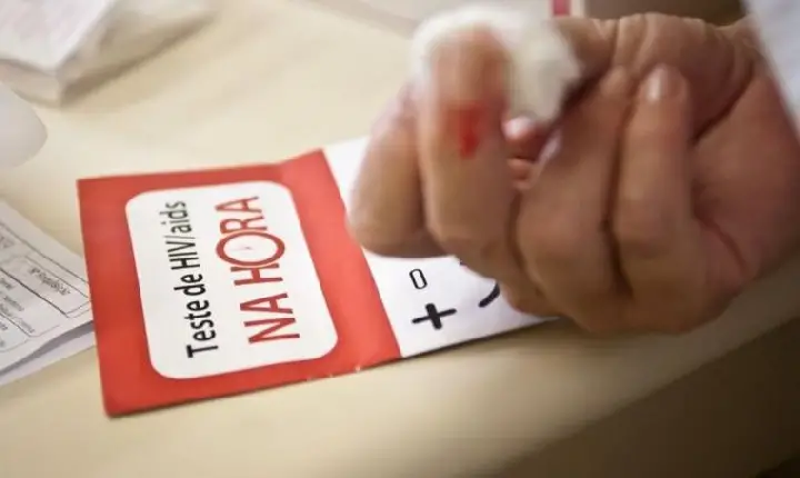 Na contramão do país, Tocantins registra aumento de mortes por Aids; mais de 70 em 2022